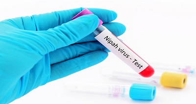 केरल के कोझिकोड में चौथे दिन भी निपाह का कोई नया मामला नहीं, पॉजिटिव मरीज भी पहले से अधिक स्वस्थ